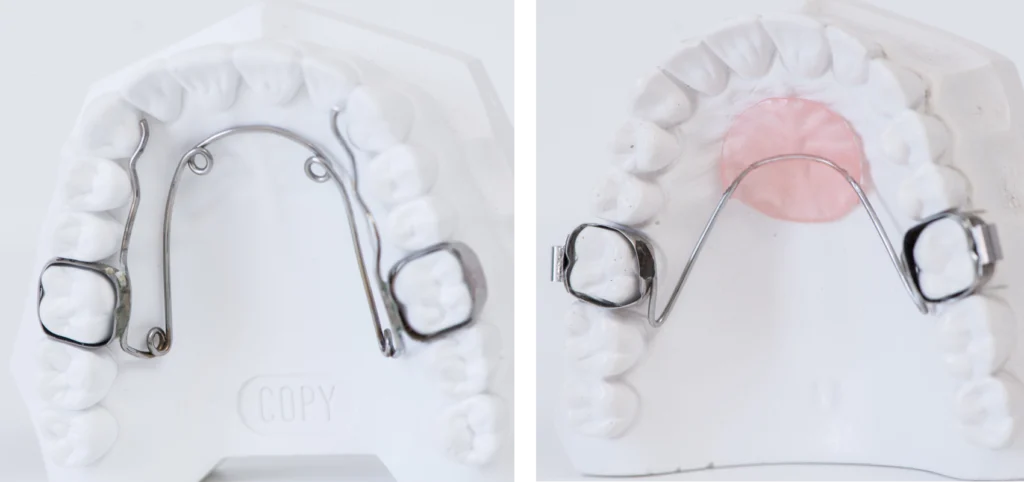 orthodontiste enfants putraux proche nanterre Orthodontie enfant wongeczowski