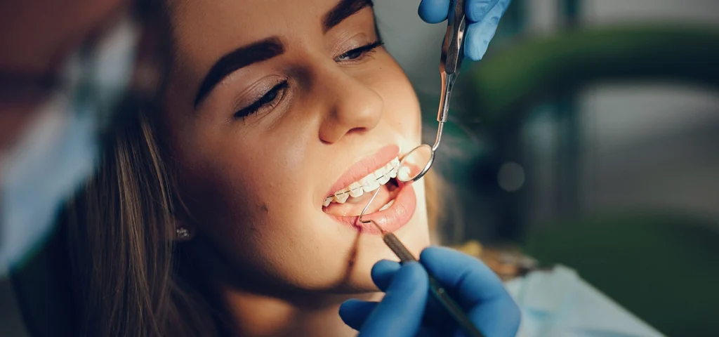 appareils dentaire metaliques ceramiques puteaux x Orthodontie adulte wongeczowski